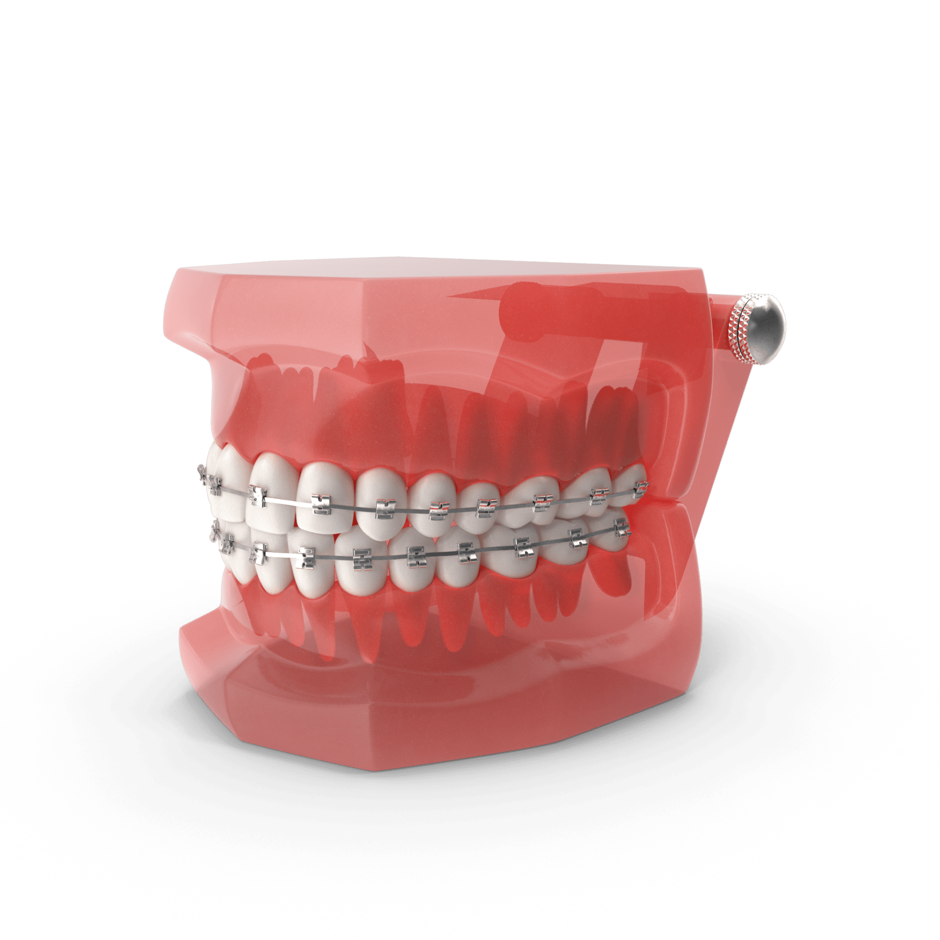 Orthodontist in Nashville, TN - Orthodontic Procedures, Braces