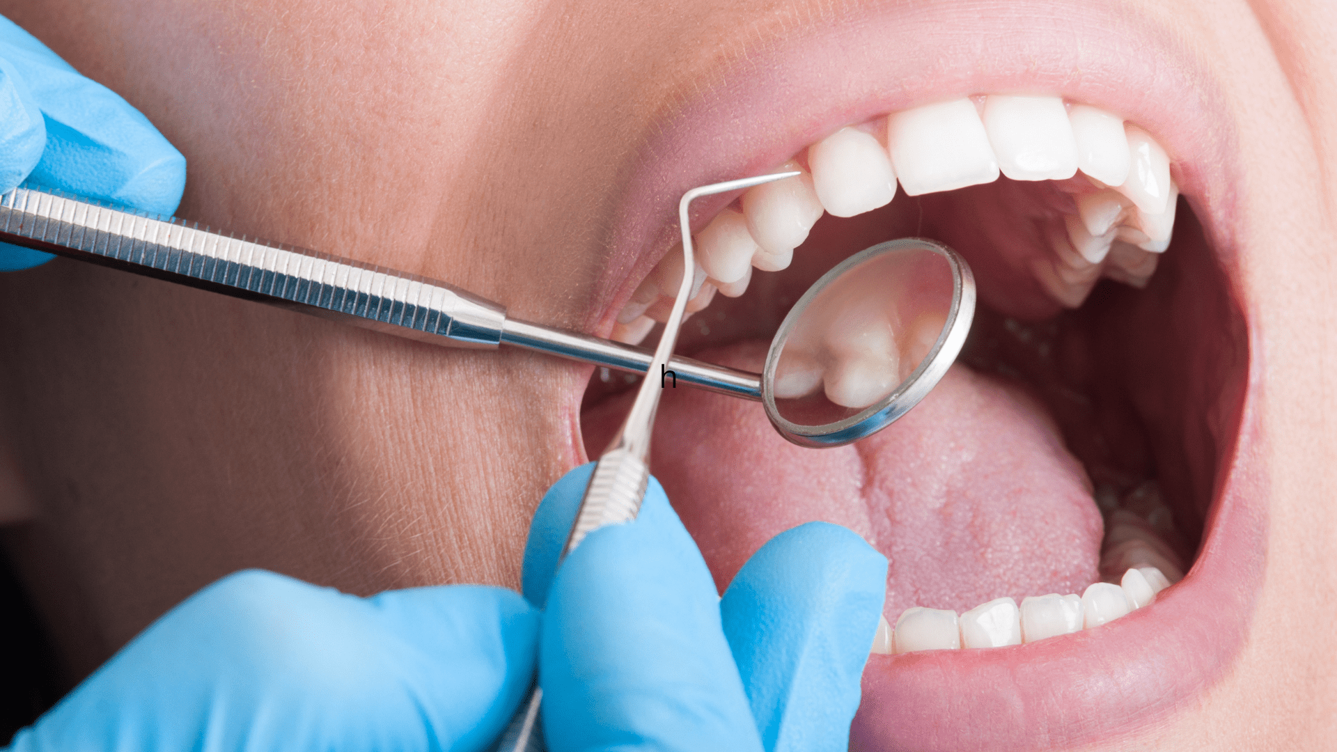 Nashville dentist checking teeth after cleaning